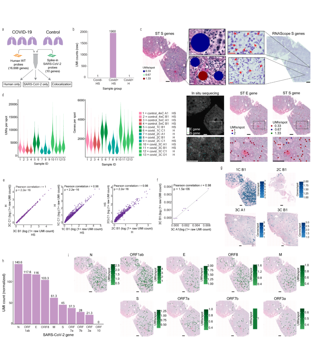 FFPE空间转录组解析人肺感染SARS-CoV-2 空间共定位新机制[2]