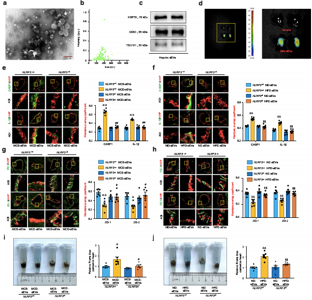 循环NAFLD肝源性外泌体诱导冠状动脉微血管中NLRP3免疫酶体依赖性的内皮细胞高通透性