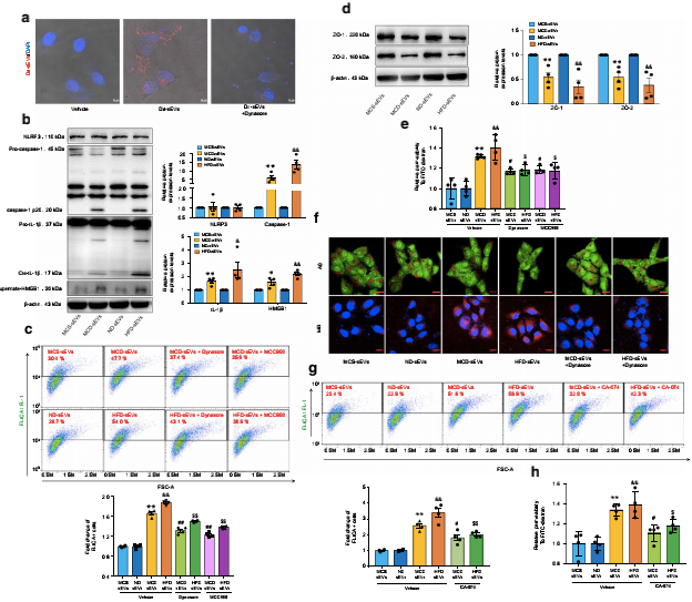 NAFLD肝源性外泌体通过激活组织蛋白酶B/NLRP3免疫激酶体轴诱导微血管内皮细胞高通透性