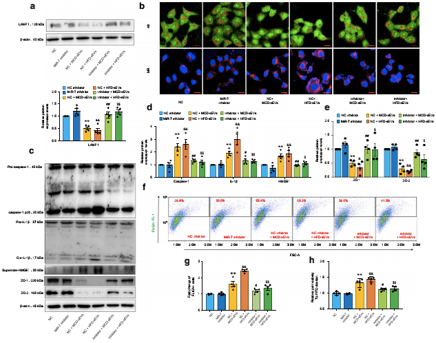novel-miR-7的基因抑制可改善NAFLD肝源性外泌体诱导的微血管内皮高通透性