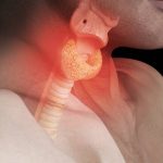 合作文章|单细胞转录组联合多组学揭示桥本甲状腺炎与弥漫性甲状腺肿的疾病微环境免疫动态图谱