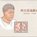 单细胞全基因组测序（scWGS）重新揭秘阿尔茨海默病神经元的体细胞突变