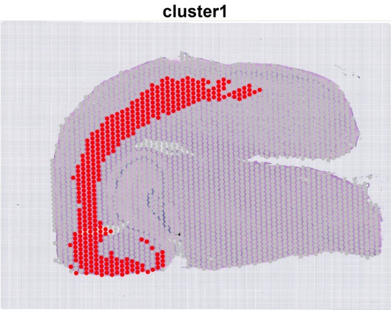 cluster1