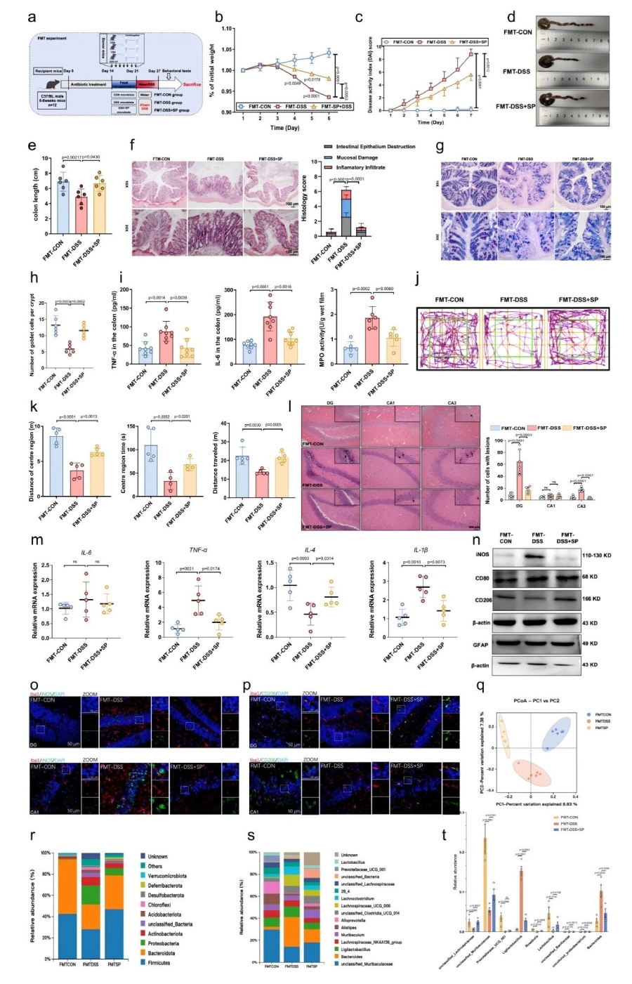 图5 FMT实验表明SP通过调节肠道菌群减轻了DSS诱导的结肠炎和焦虑样行为