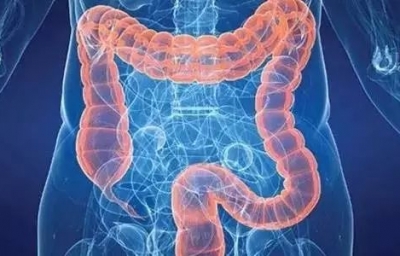 【前沿资讯】KRAS突变促进结直肠癌肝转移的机制研究