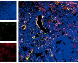 《cell reports》慢性肉芽肿病的发病机制新发现