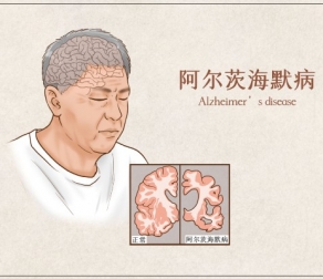 单细胞全基因组测序（scWGS）重新揭秘阿尔茨海默病神经元的体细胞突变