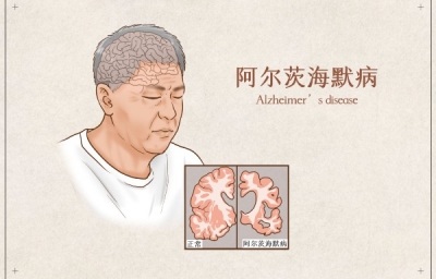 单细胞全基因组测序（scWGS）重新揭秘阿尔茨海默病神经元的体细胞突变